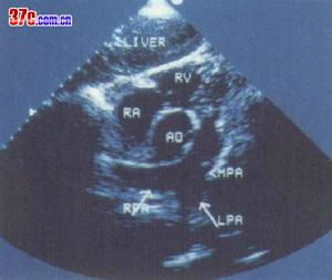 肺病有哪些輔助檢查方法