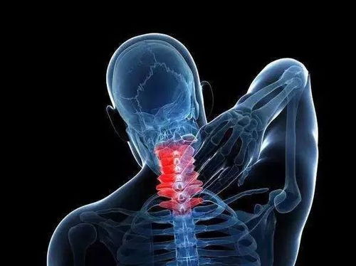頸椎病臨床治療有哪些方法