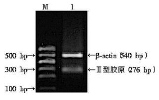提取動物rna的方法有哪些
