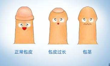 常用包皮過(guò)長(cháng)治療方法有哪些