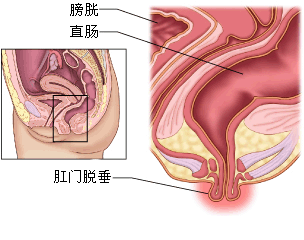 辨別膿腫的方法有哪些