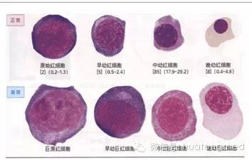 有哪些方法可以辨認血細胞