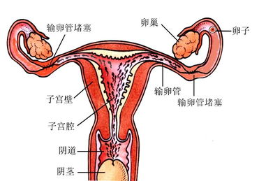治輸卵管不通最佳方法有哪些方法