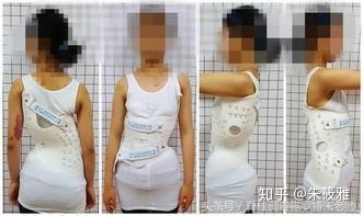 肢具佩戴注意事項