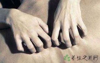 人工性蕁麻疹注意事項,熱性蕁麻疹注意事項,季節性蕁麻疹注意事項