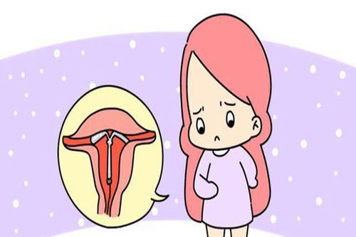 女人裝環(huán)后注意事項