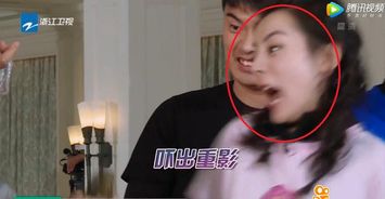 注意事項,護士服