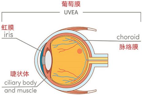 青少得葡萄膜炎應該注意事項