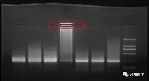 電泳,注意事項,實(shí)驗