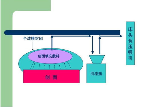 vsd負壓吸引的注意事項