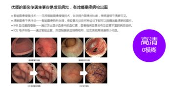 做胃鏡前注意事項m.baidu.com