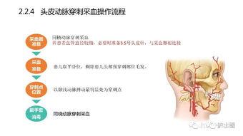 血?dú)?標(biāo)本,時應(yīng),注意事項(xiàng)