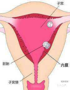 試管宮腔鏡手術后注意事項,宮腔鏡后注意事項和飲食注意,宮腔鏡手術后注意事項