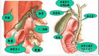 陰囊,結(jié)石,注意事項(xiàng),飲食
