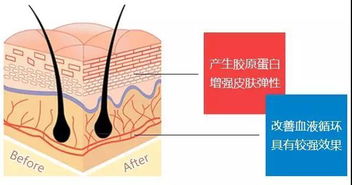 螺旋線(xiàn),埋入,韓國,蛋白