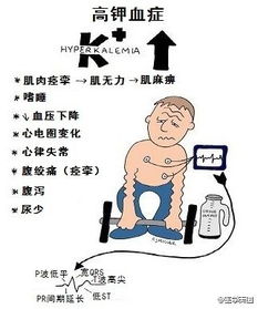 請闡述靜脈補鉀的注意事項