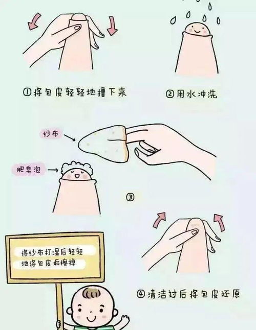 包皮套扎術(shù)注意事項