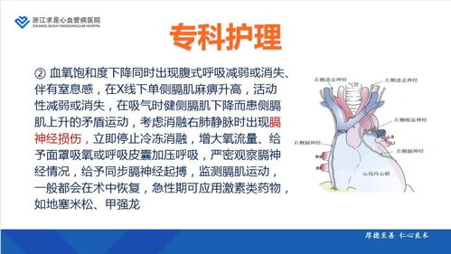導管消融術(shù)后注意事項