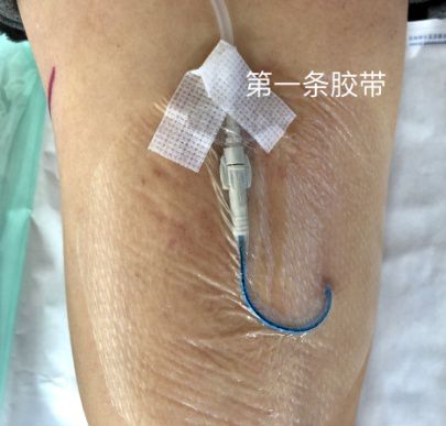 picc更換敷貼注意事項