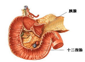 胰腺癌術(shù)后飲食注意事項(xiàng),胰腺腫瘤飲食注意事項(xiàng),胰腺手術(shù)后注意事項(xiàng)