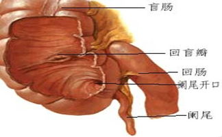 闌尾,人手,術(shù)前,注意事項
