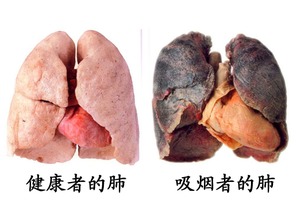 注意事項