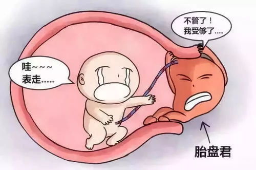 32周胎盤前置注意事項