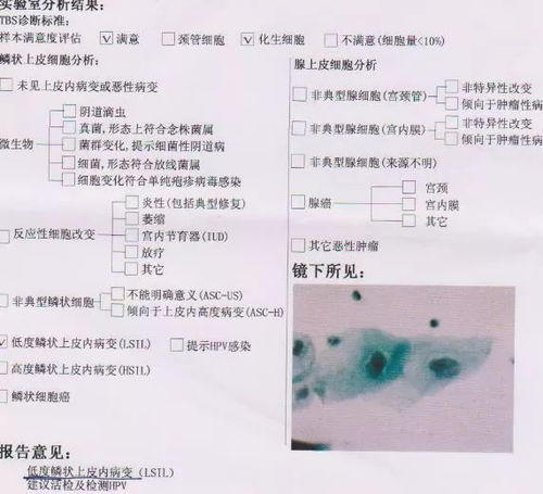 標(biāo)本,注意事項,TCT