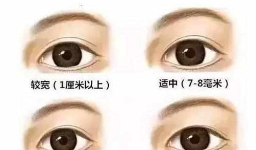 割雙眼皮睡覺(jué)注意事項