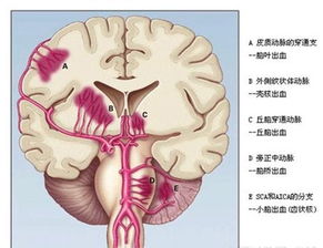 腦出血患者鼻飼注意事項,腦出血昏迷鼻飼注意事項,鼻飼的護理和注意事項