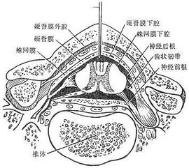 脊椎麻醉后注意事項,脊椎正骨后的注意事項,脊椎復位后注意事項