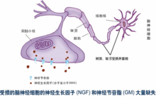 神經(jīng)移植注意事項