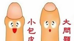 割包皮后的注意事項有哪些