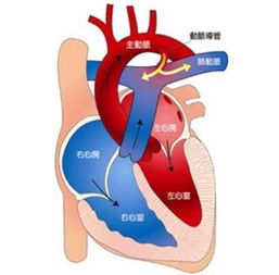 嬰兒肺動(dòng)脈高壓應注意事項