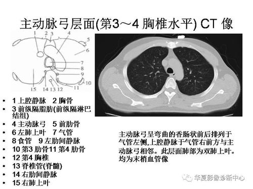 ct讀片基礎(chǔ)知識(shí)