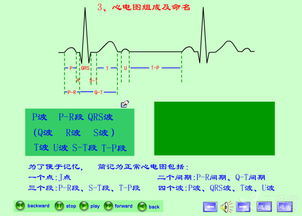 最新章節心電圖基礎知識1