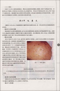 皮膚美容科學(xué)基礎知識